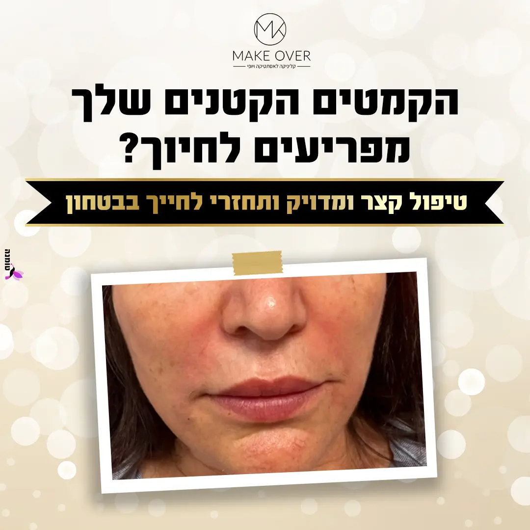 לקוח מייקאובר אילת קידום פייסבוק ואינסטגרם טומנה